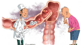 viêm trực tràng